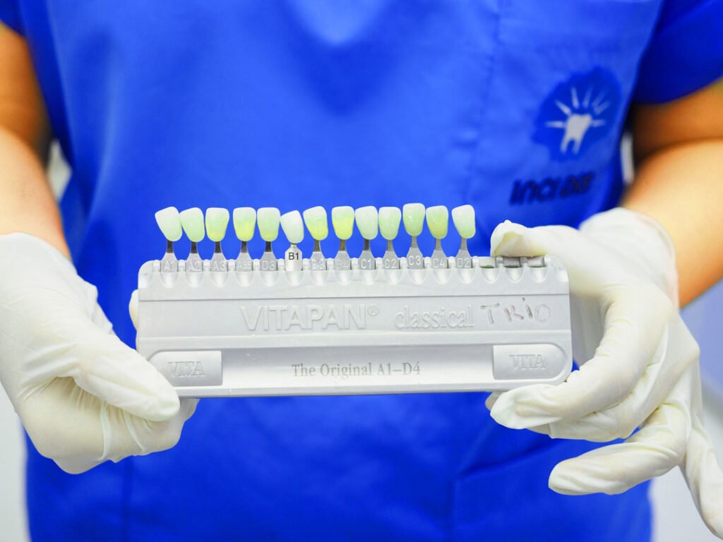 Laminate Veneers Turkey